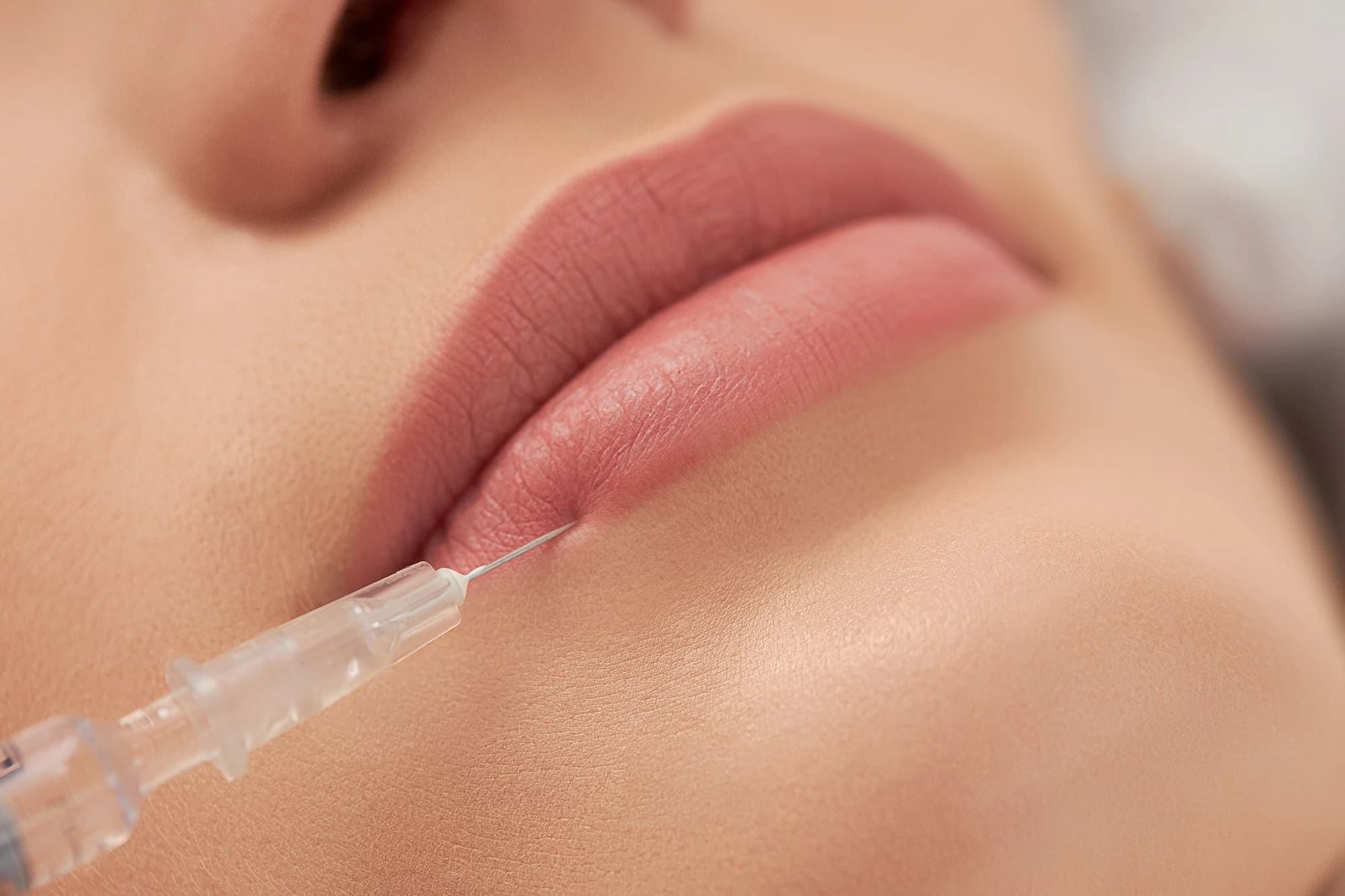 Lip Augmentation: Contraindications and Side Effects Your Cosmetologist Must Warn You About Before the Session Lip Augmentation: Contraindications and Side Effects Your Cosmetologist Must Warn You About Before the Session